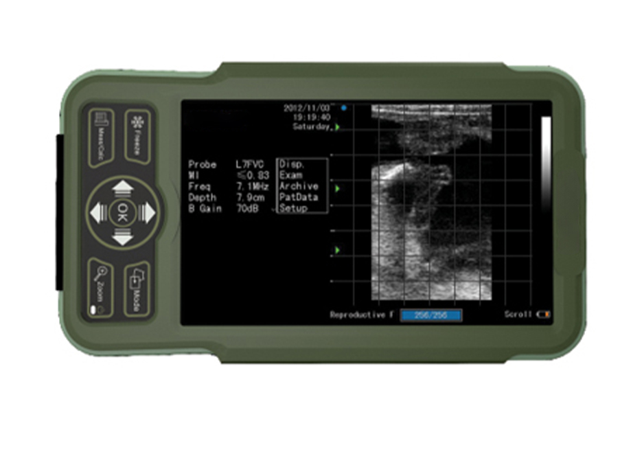 掌上獸醫(yī)超聲系統醫(yī)療設備設計